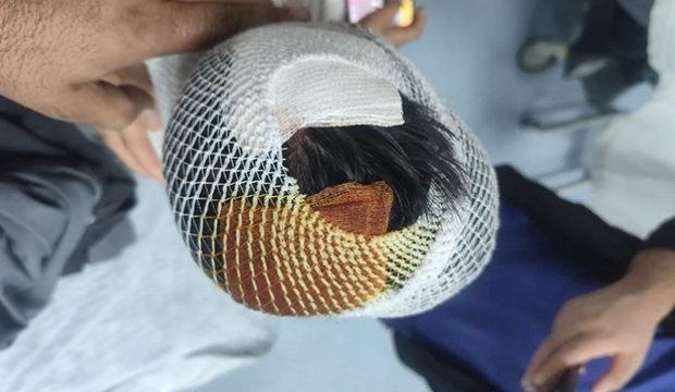 Şanlıurfa Viranşehir'de köpek saldırısı: 8 çocuk yaralandı