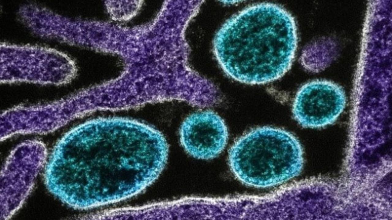 Dünya Sağlık Örgütü ilk insan Shamonda virüsü vakasını araştırıyor