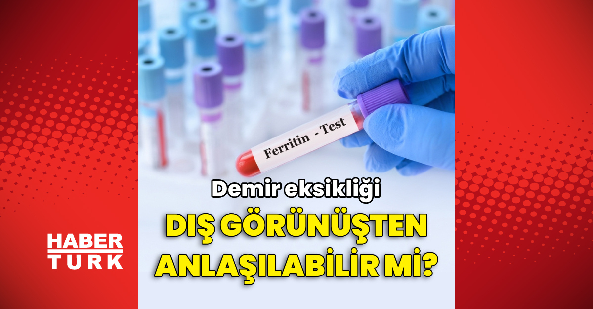 Demir eksikliği dış görünüşten anlaşılabilir mi?