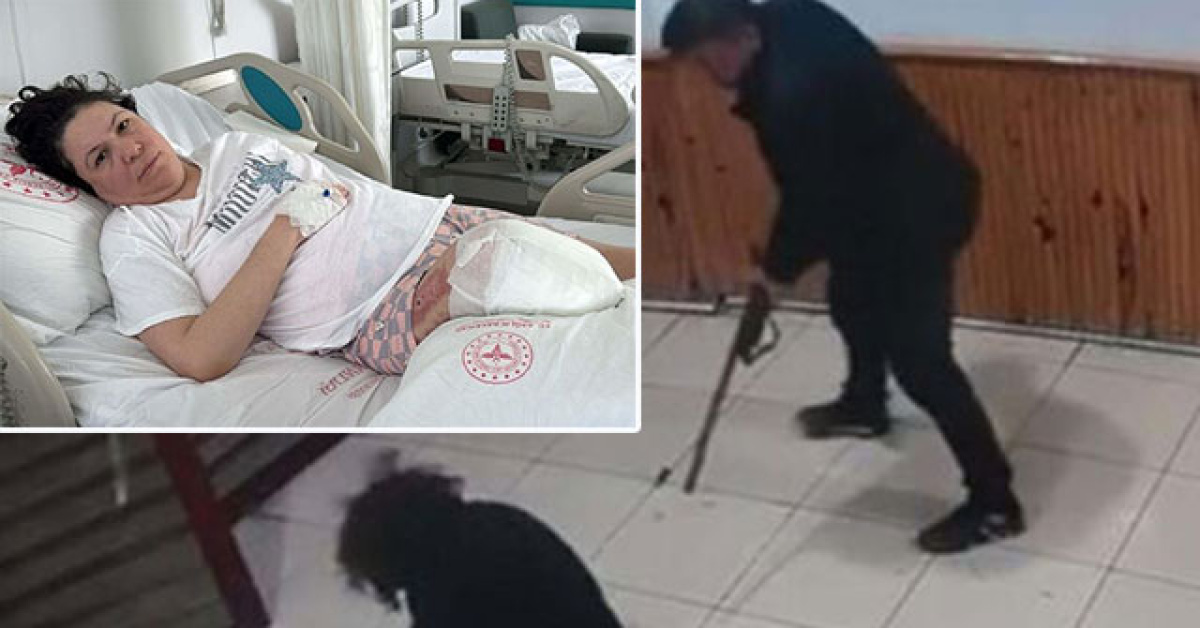 Hatice Katrancı'nın saldırı sonrası sağ bacağı da kesildi